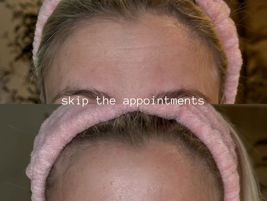 how re-du™ can enhance your injectable results or be your effective alternative