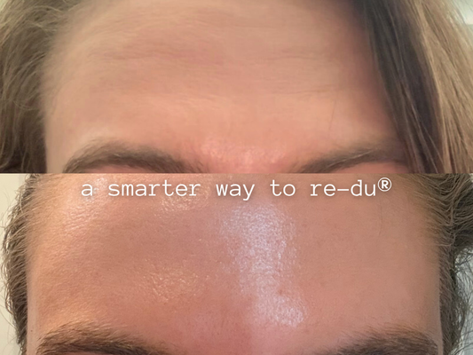 There is a smarter way to re-du®